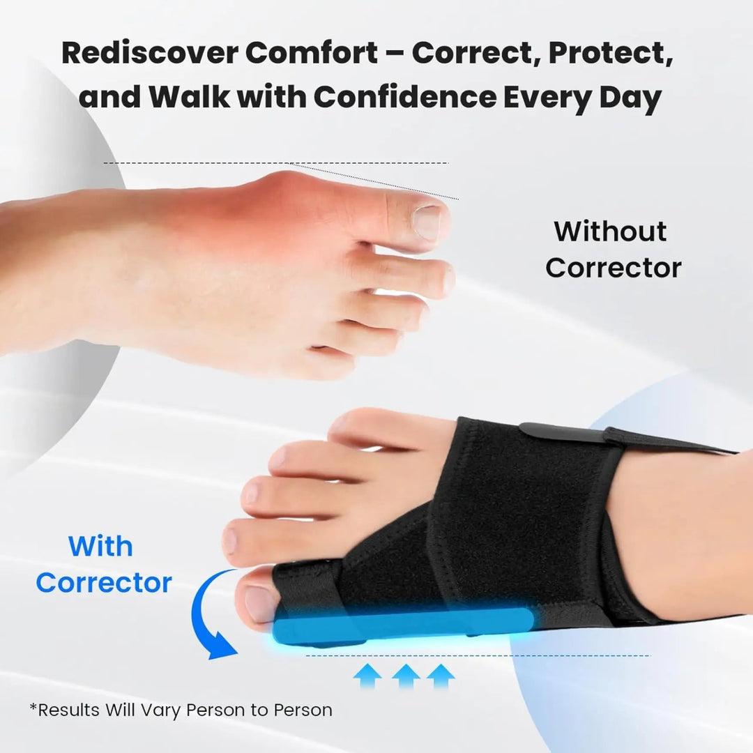 Bunion Support Toe Straightener Sleeve with Breathable Splint, Left and Right | Comfortable Big Toe Support | Foot Supports