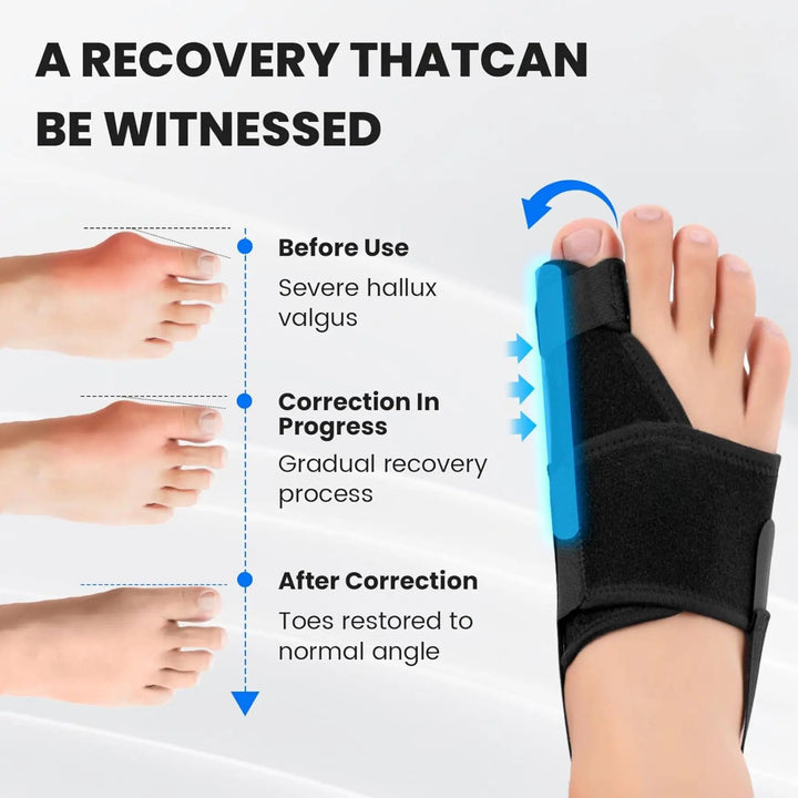 Bunion Support Toe Straightener Sleeve with Breathable Splint, Left and Right | Comfortable Big Toe Support | Foot Supports