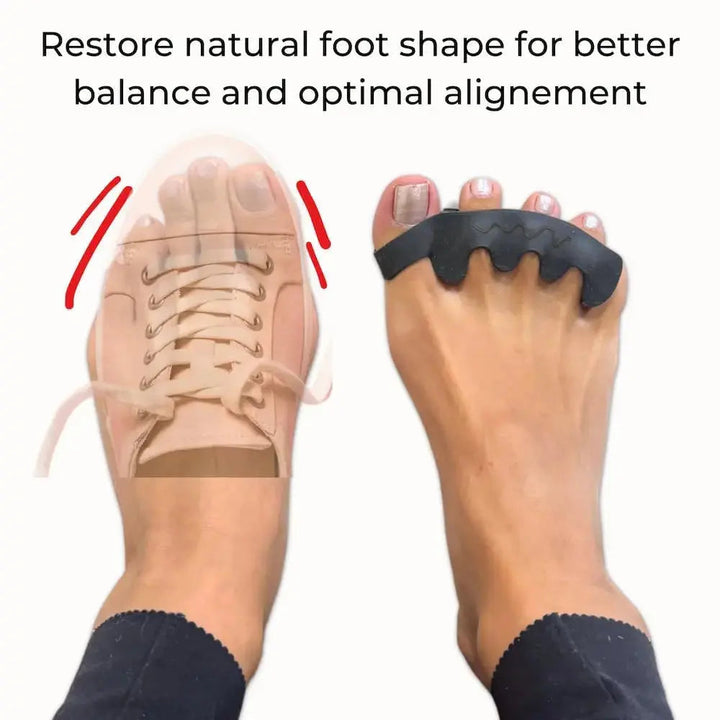 Soft Flexible Silicone Toe Spacer Set for Daily Comfort in Four Colours | Gentle Toe Separation | Foot Supports