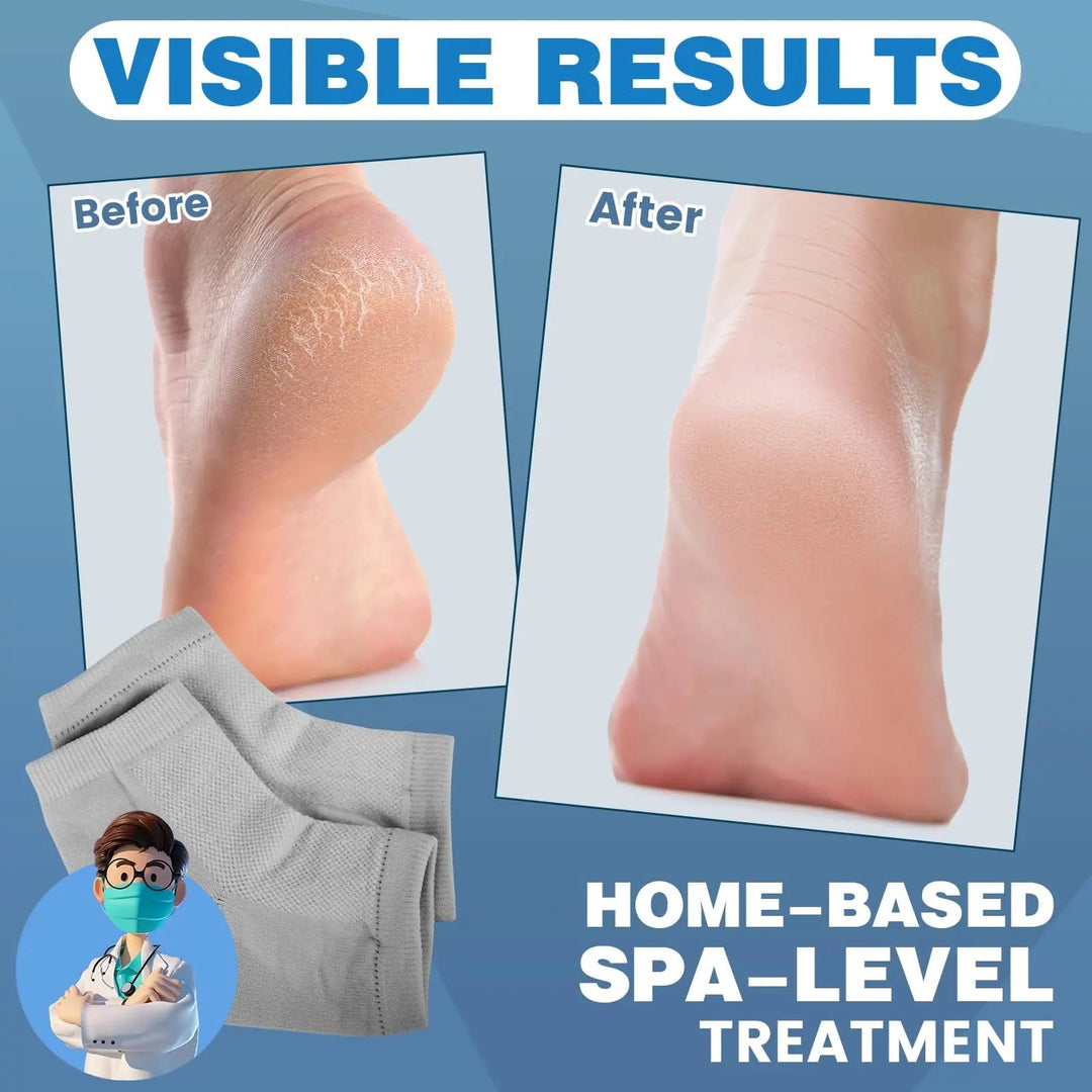 Silicone Gel Heel Socks, 6 Pairs, Moisturising Reusable Foot Protector | Heel Care Socks for Soft Feet | Spa Socks